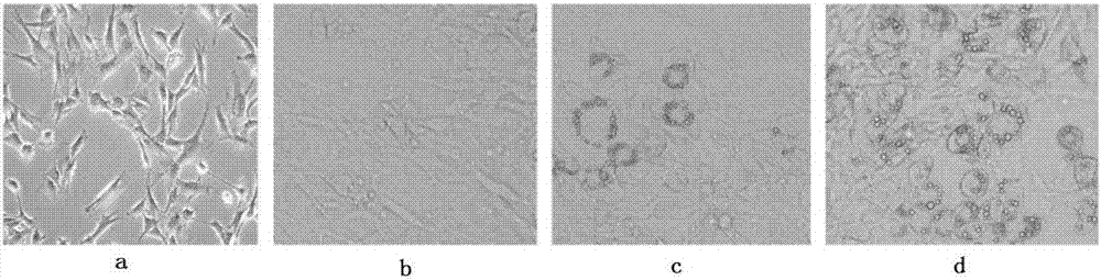 Purpose of rhapontin in preparation of medicine for treating insulin-resistant relevant diseases