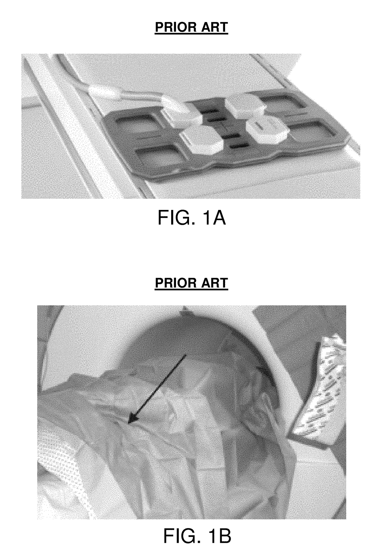 Magnetic Resonance Imaging Coil With Adjustable Opening