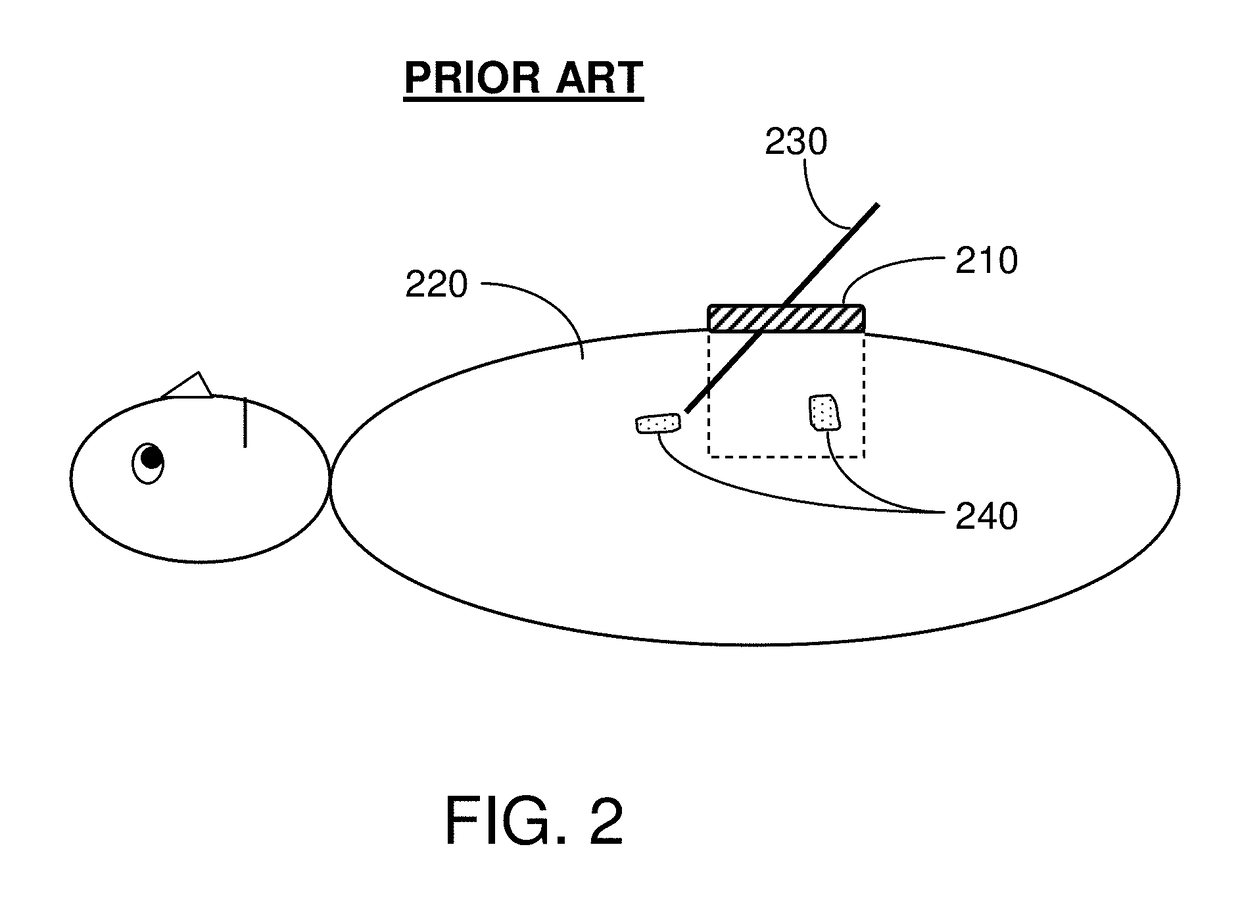 Magnetic Resonance Imaging Coil With Adjustable Opening