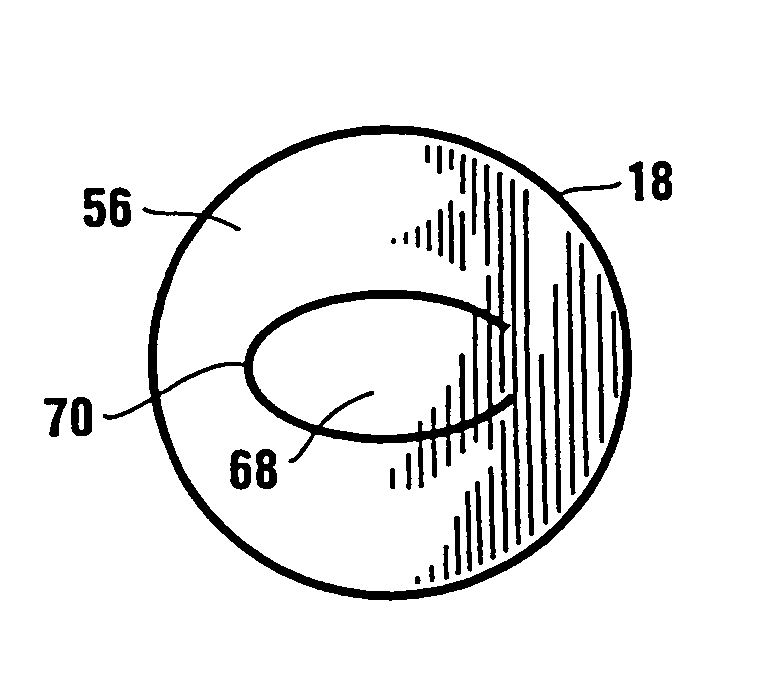 Method of corneal surgery by laser incising a contoured corneal flap