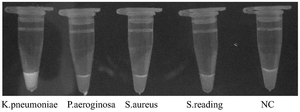 Loop-mediated isothermal amplification (LAMP) primers, kit and method for detecting mouse Klebsiella pneumoniae