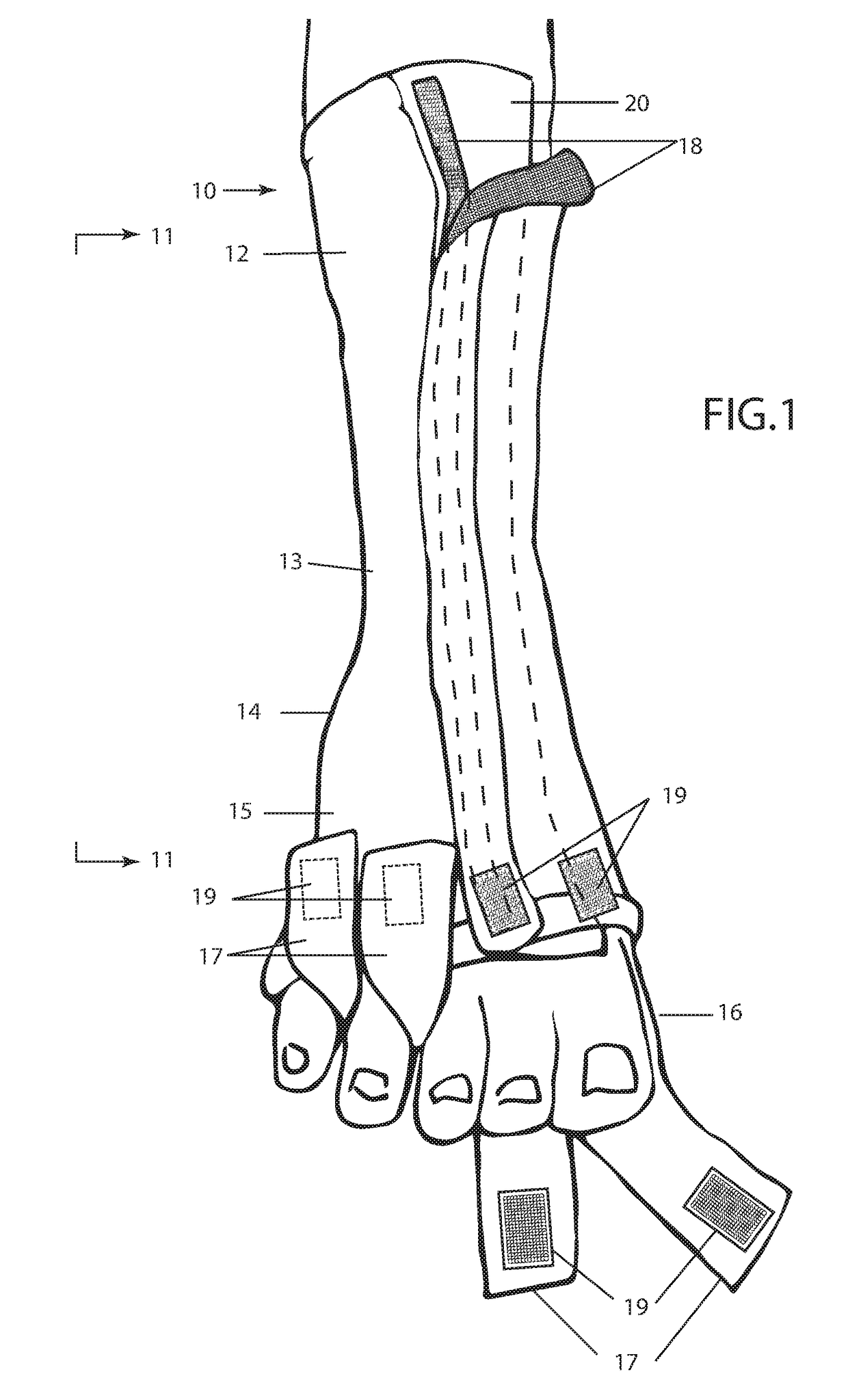 Open Front Pedicure Sock