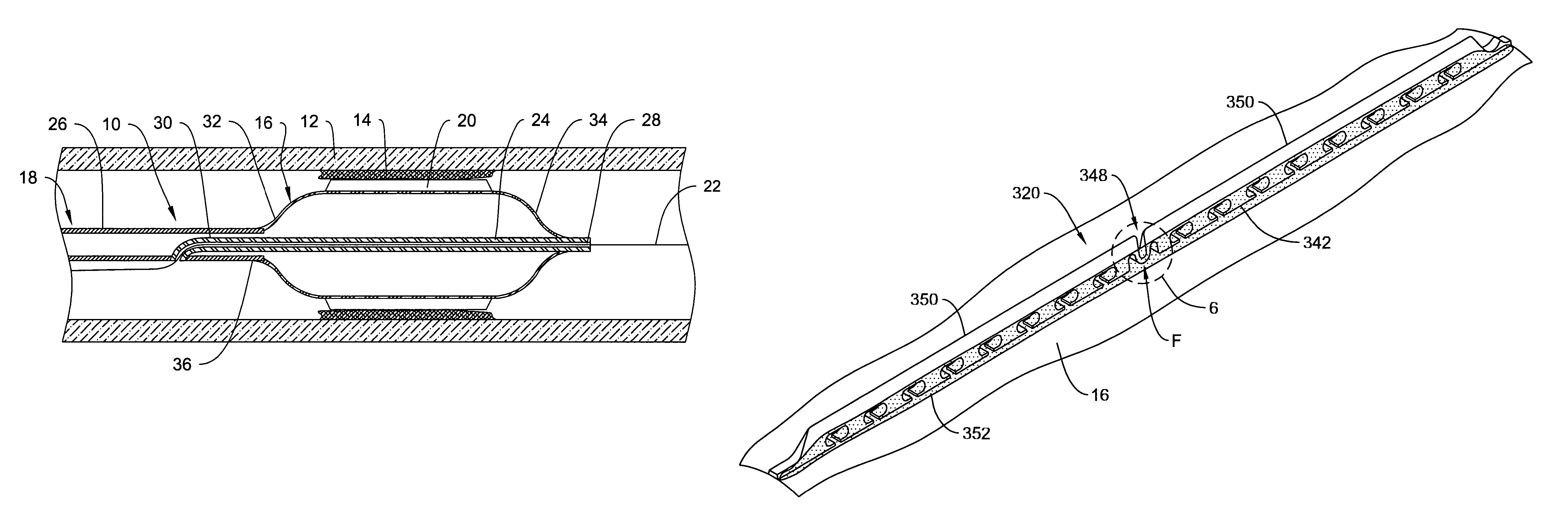 Cutting balloon catheter having flexible atherotomes