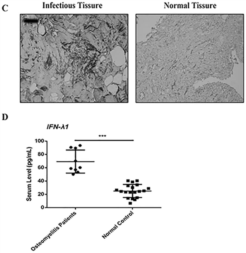 Application of recombinant ifn-λ1 protein in the preparation of drugs for preventing and treating inflammatory bone loss