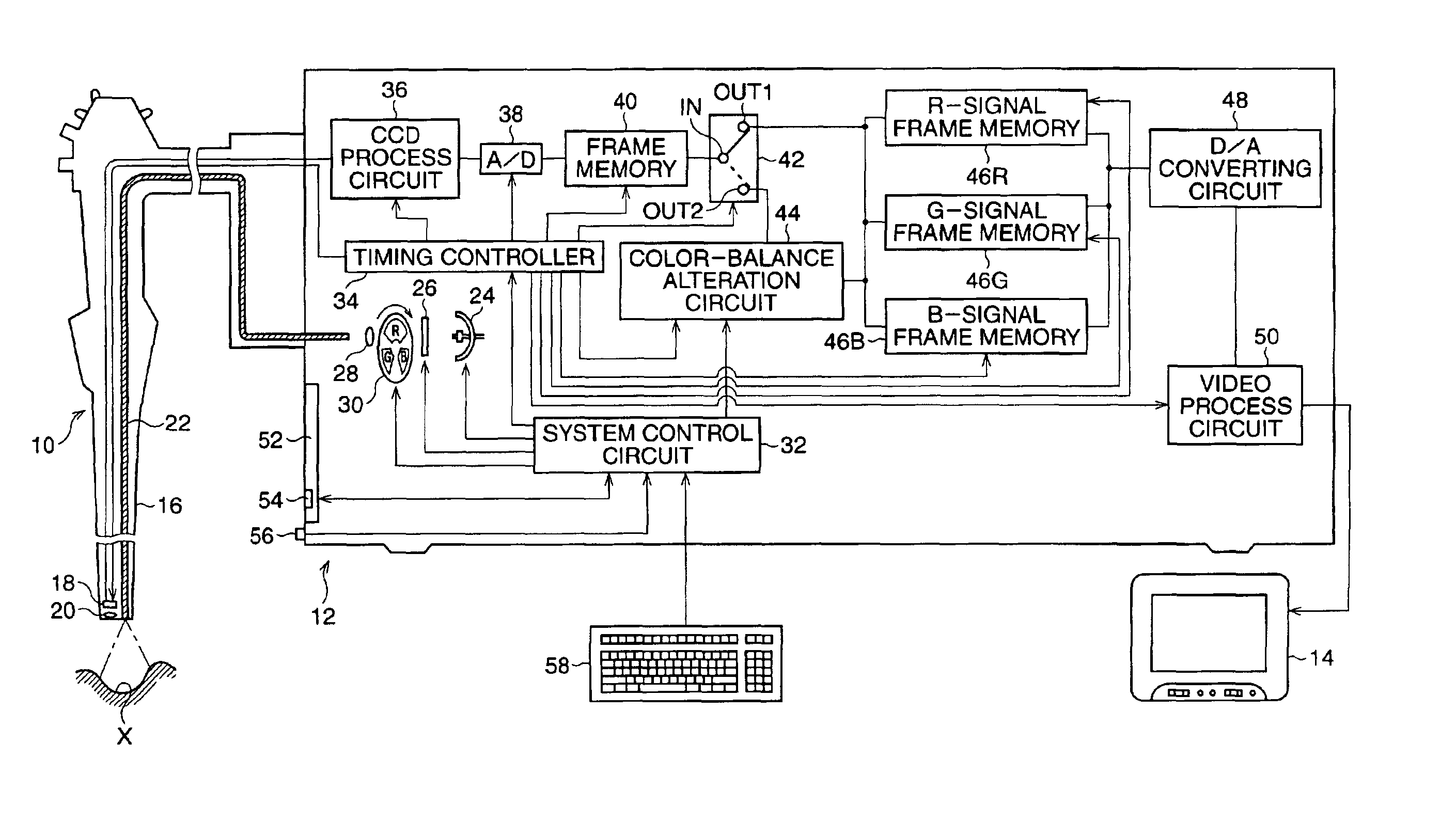 Electronic endoscope system with color-balance alteration process