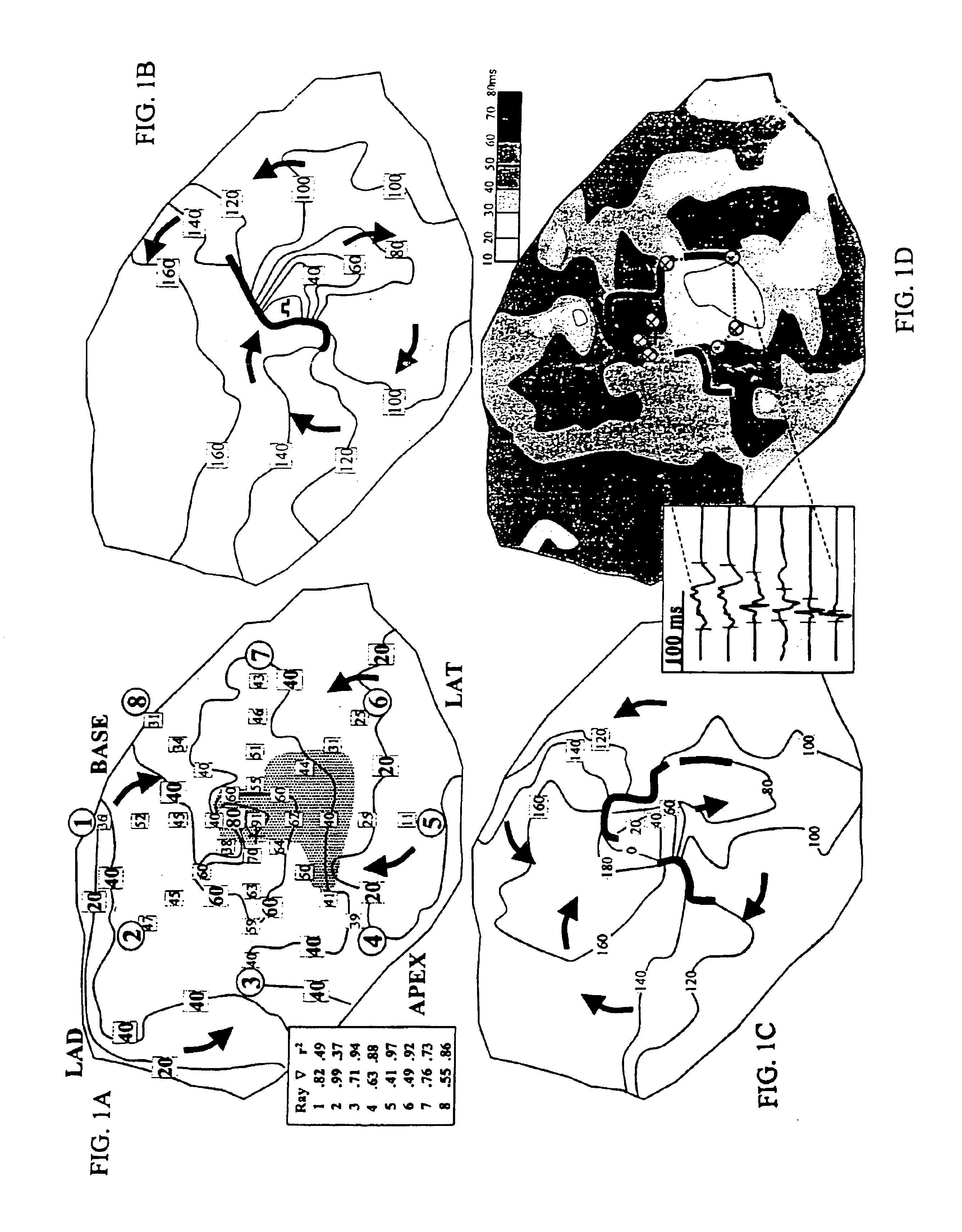 System and method for determining reentrant ventricular tachycardia isthmus location and shape for catheter ablation