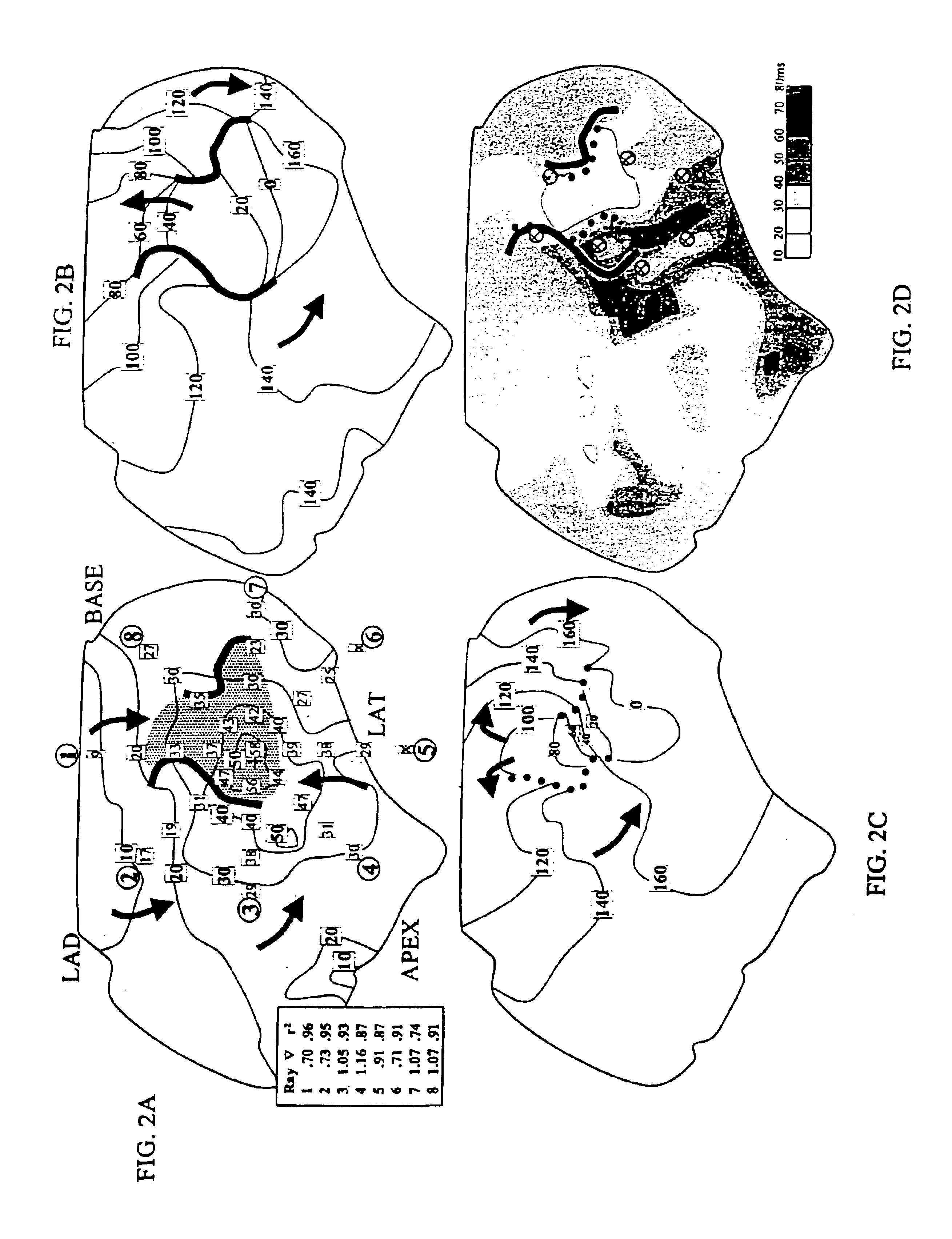 System and method for determining reentrant ventricular tachycardia isthmus location and shape for catheter ablation