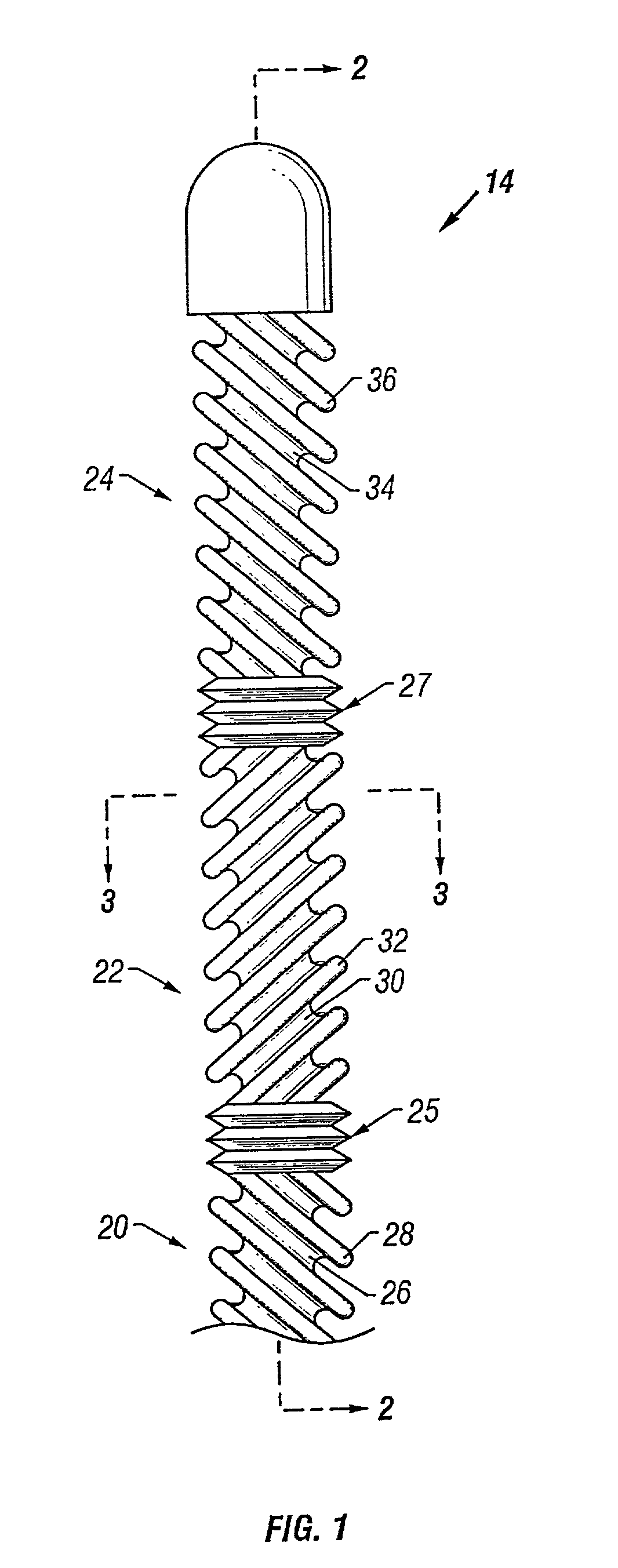 Fever regulation method and apparatus