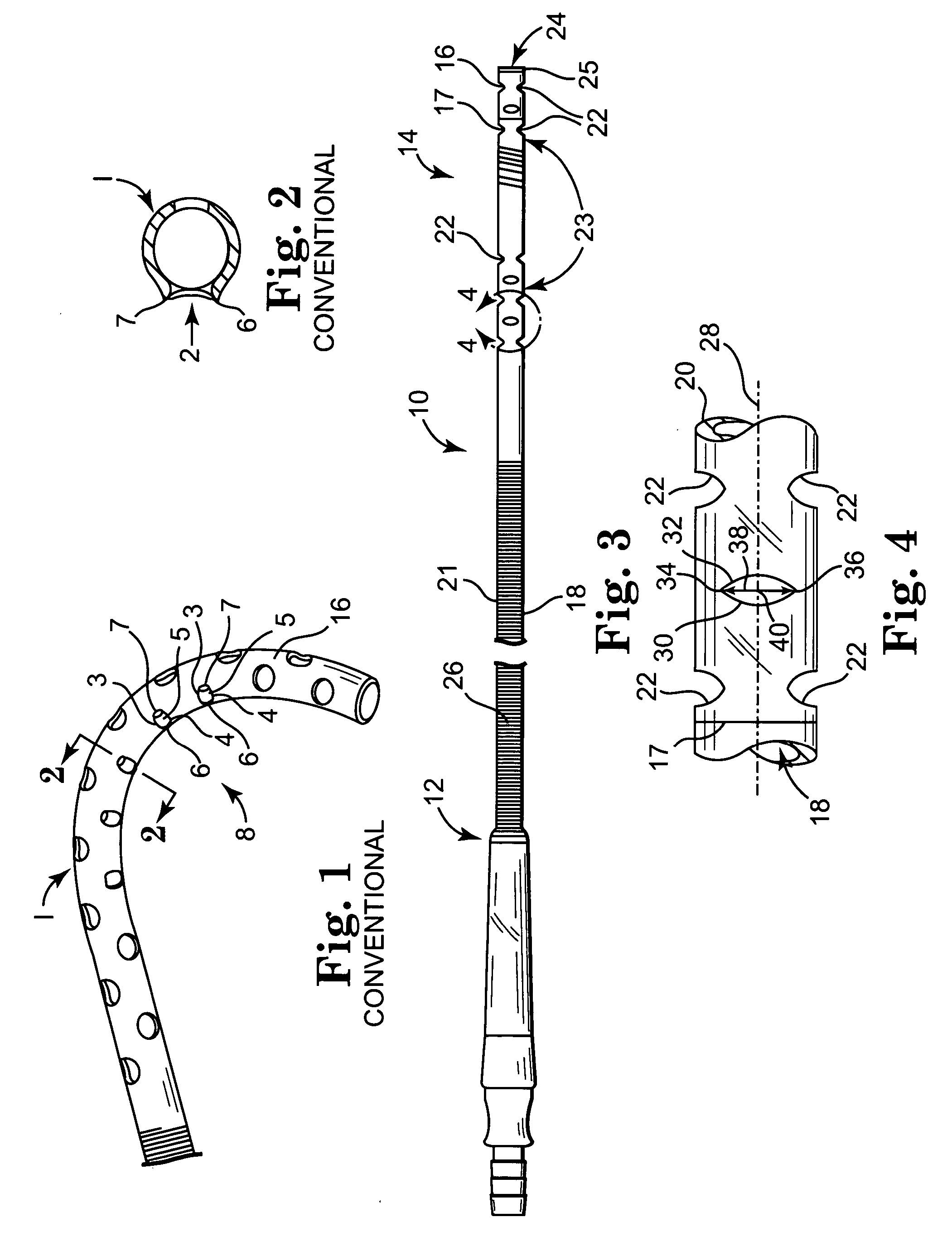 Kink resistant cannula having buckle resistant apertures