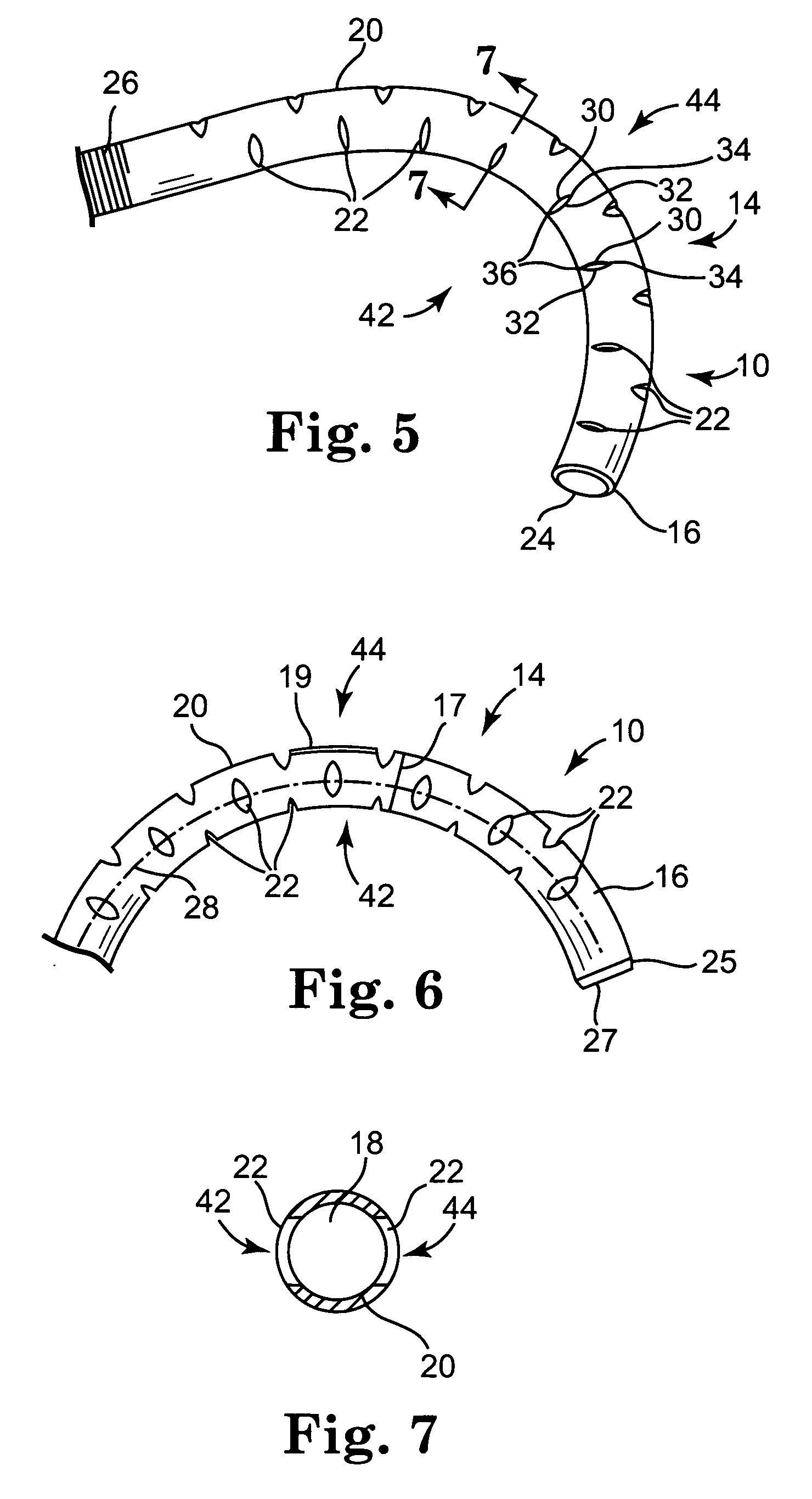 Kink resistant cannula having buckle resistant apertures