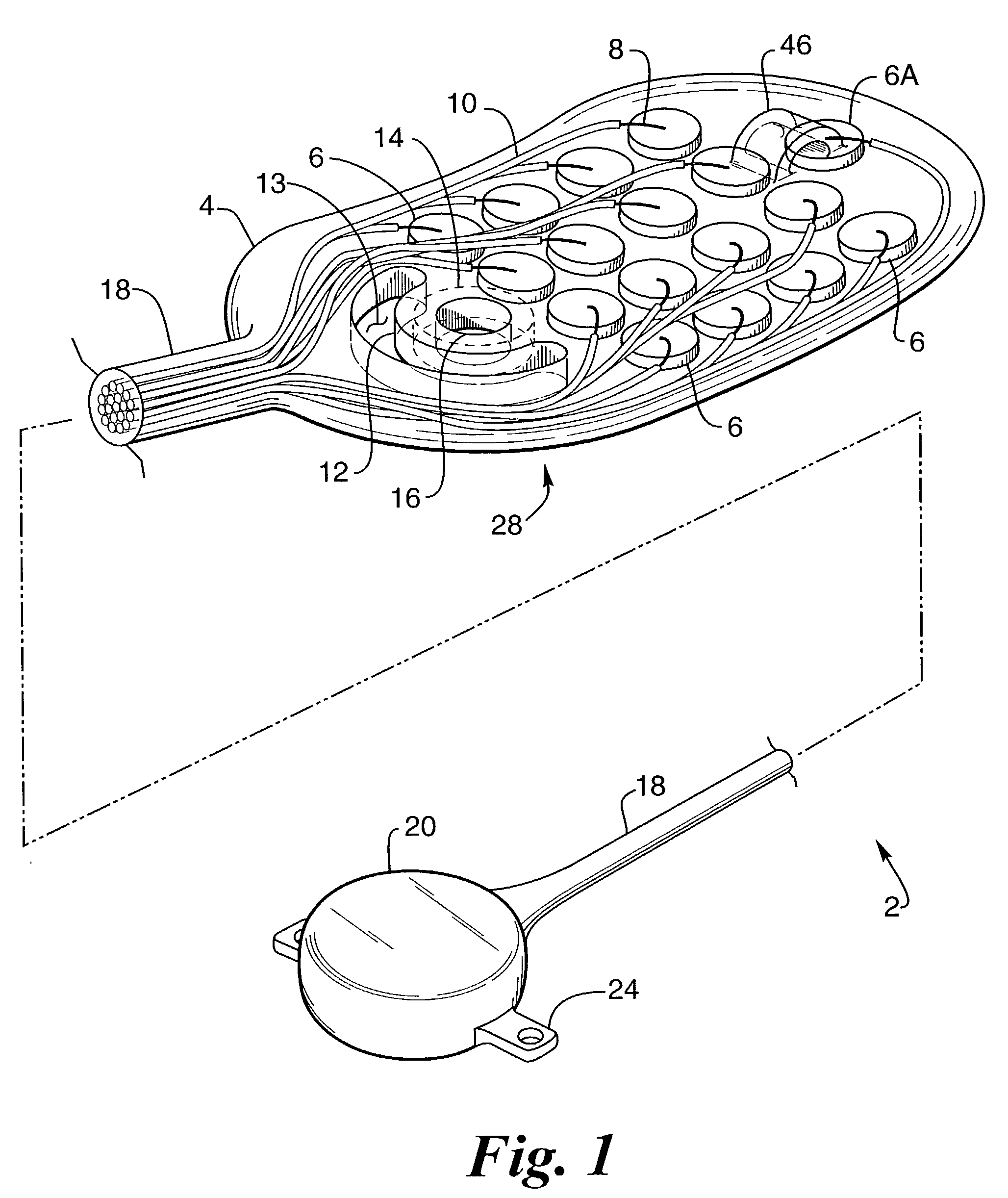 Implantable drug delivery device