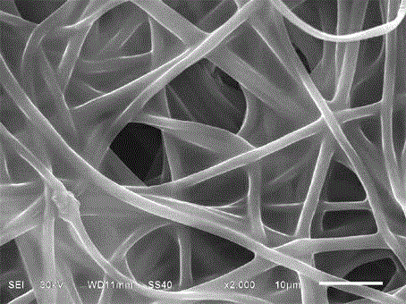 Nano composite fiber-reinforced gel polymer electrolyte and preparation method thereof