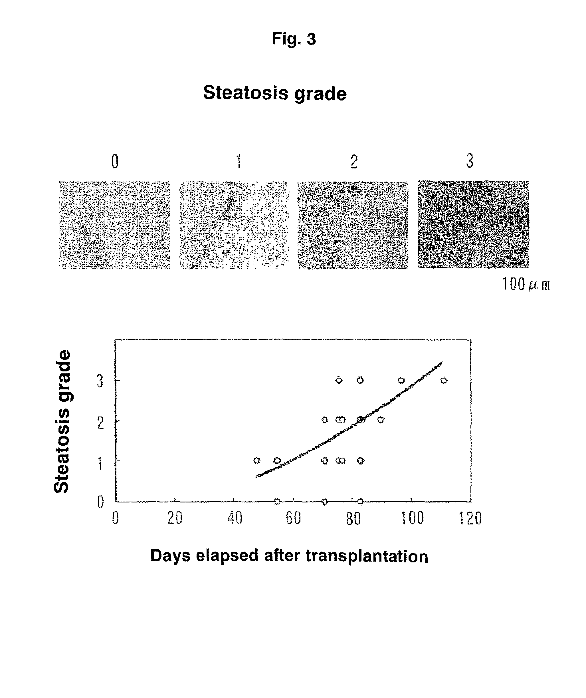 Method of treating mouse carrying human hepatocytes