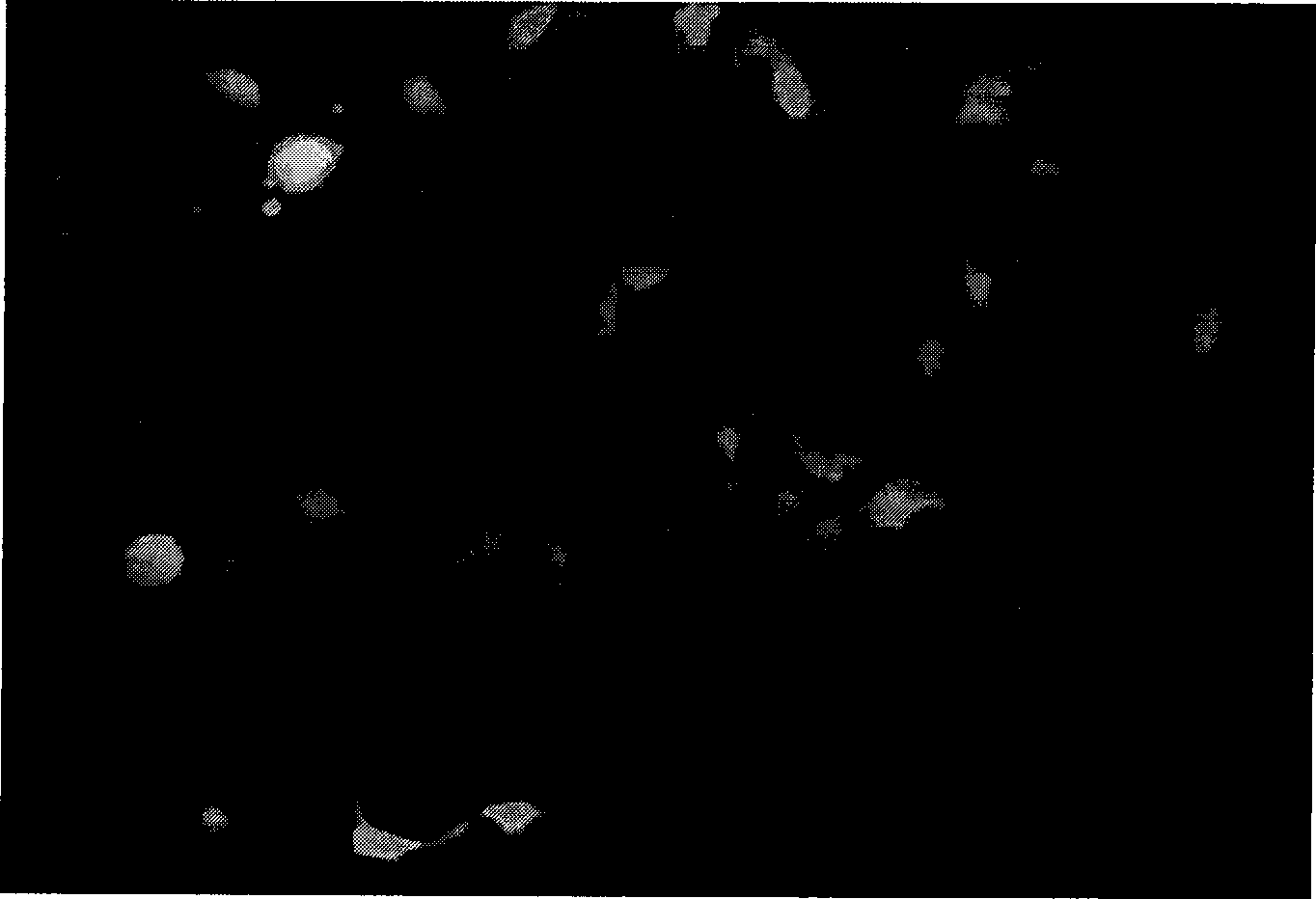 Preparation of double promoter DNA anti-caries vaccine pCN-SSIE