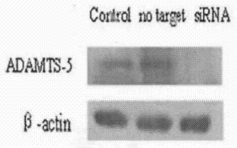 siRNA composition and application thereof for suppressing adamts-5 and adam17 genes