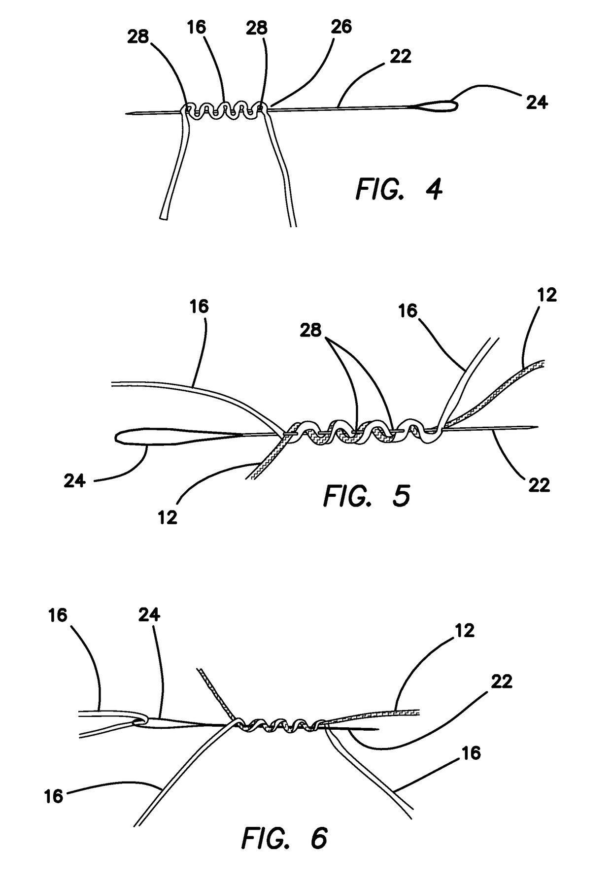 All-suture suture anchor systems and methods