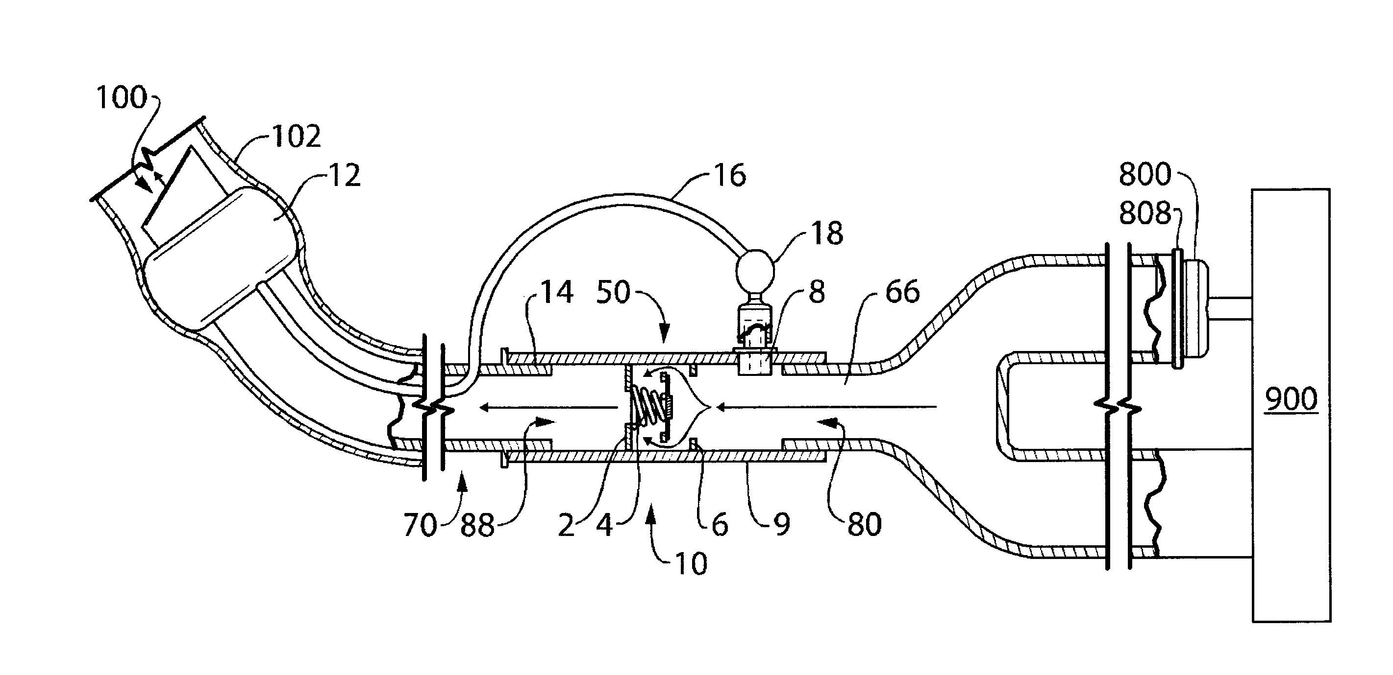 Endotracheal cuff pressure regulation circuit and method