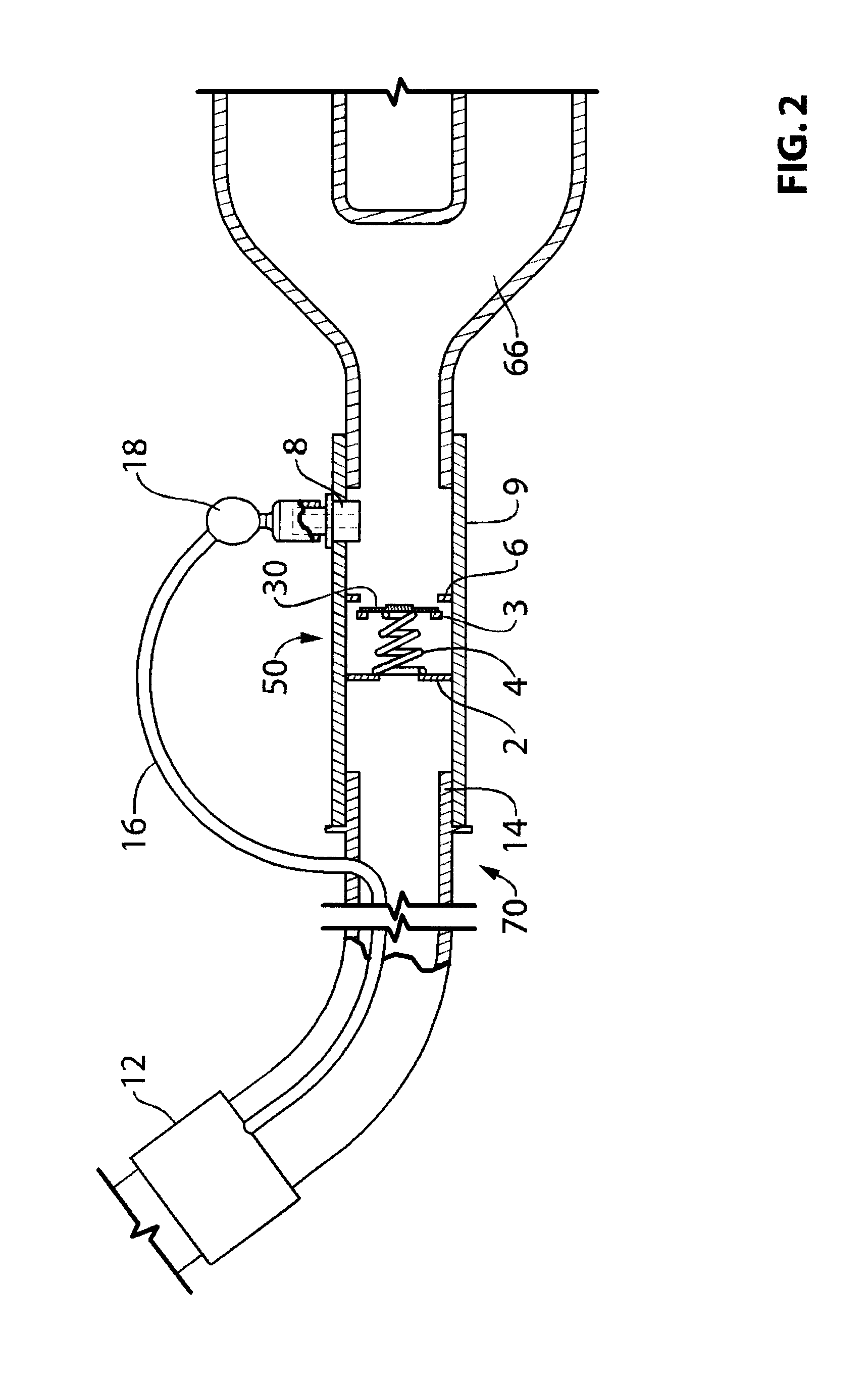 Endotracheal cuff pressure regulation circuit and method