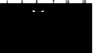 Targeted ligand-PEG (polyethylene glycol)-cholesterol/tocopherol derivative, and preparation method and application of derivative