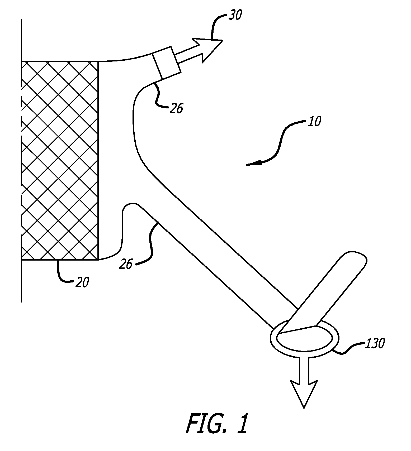 Implants and procedures for supporting anatomical structures for treating conditions such as pelvic organ prolapse