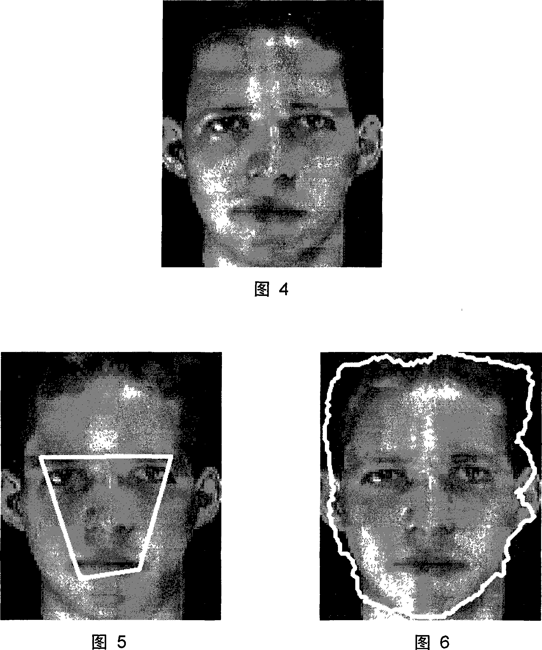 Freely differences calculus and deformable contour outline extracting system