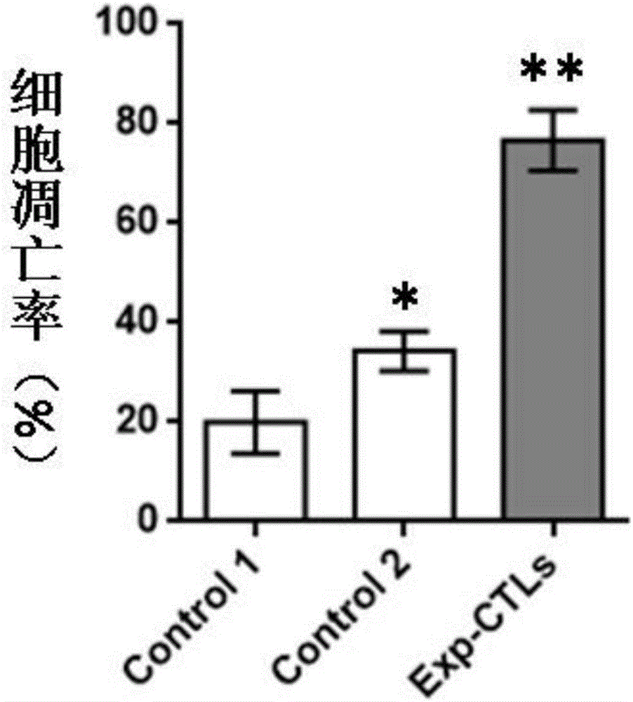 Preparing method of breast cancer specificity CTLs