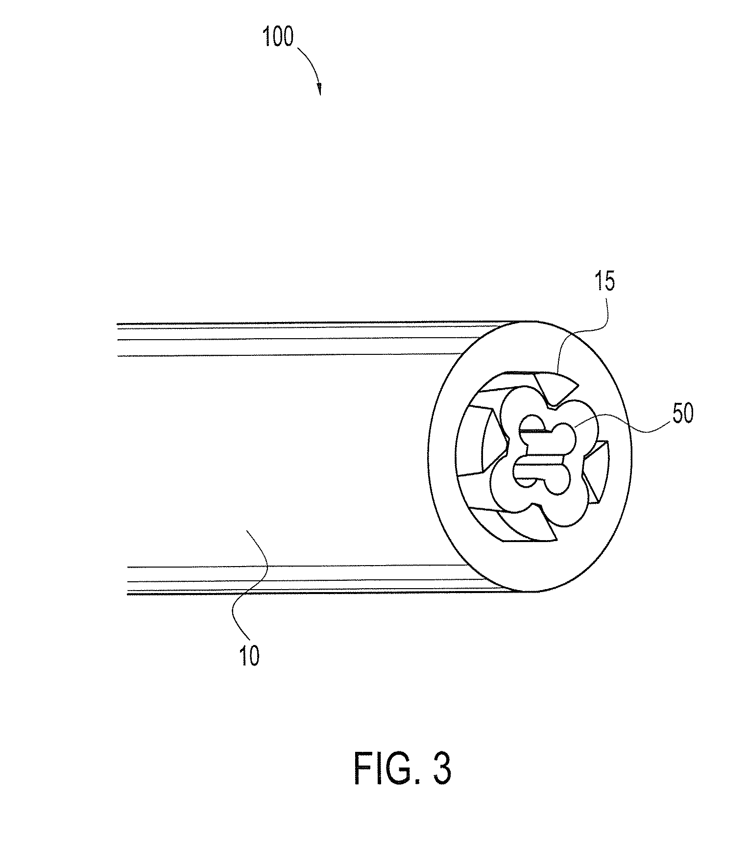 Methods of arthroscopic osteochondral resurfacing