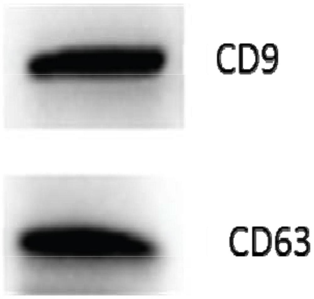 Human pluripotent stem cell exosomes loaded with photosensitizing drug and its preparation and application