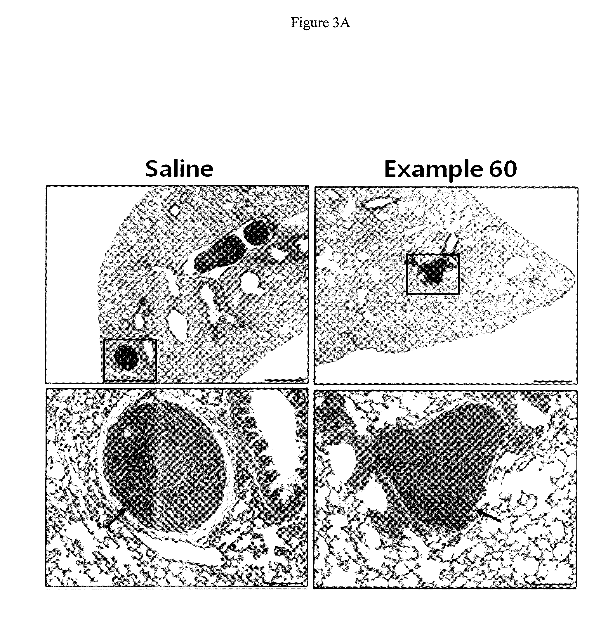 2-pyridyl substituted imidazoles as therapeutic ALK5 and/or ALK4 inhibitors