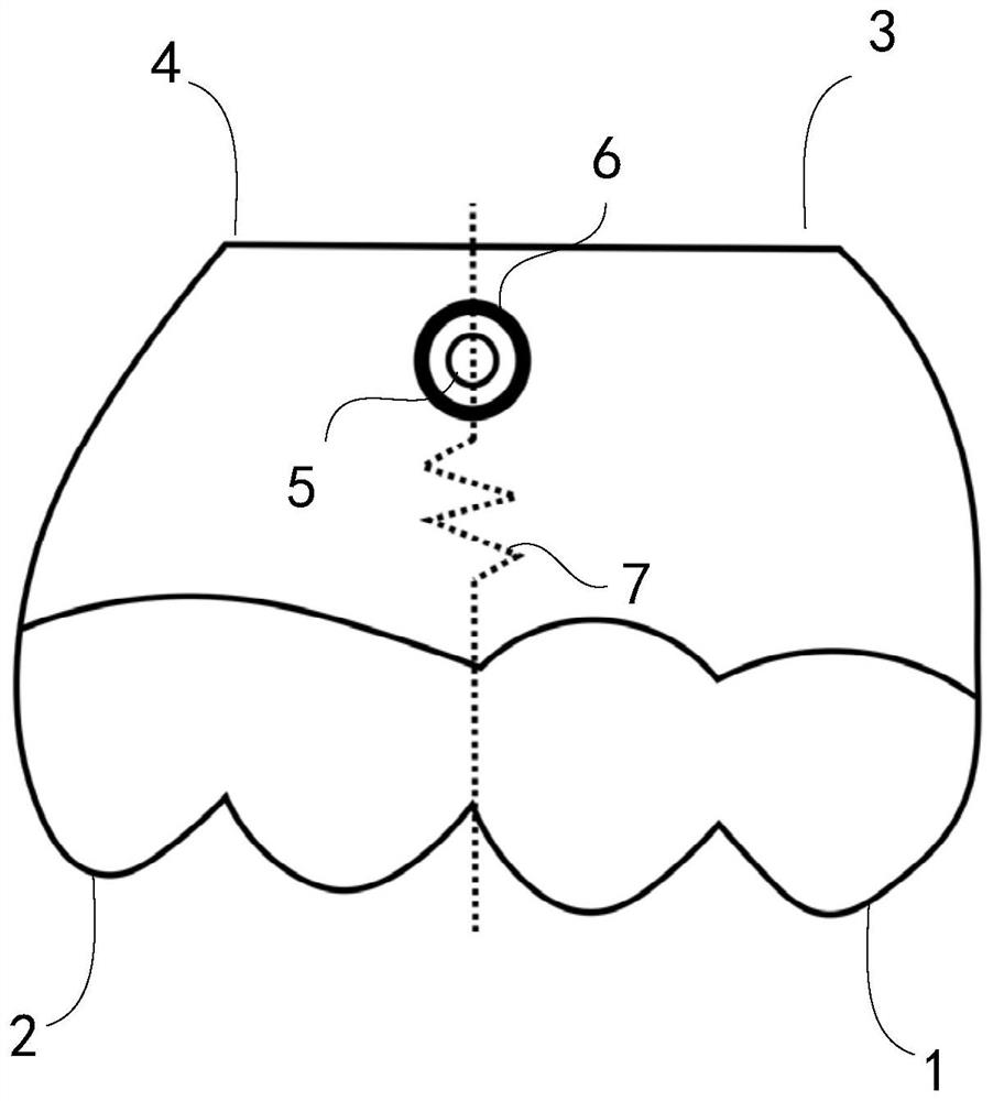 A 3D printed micro implant guide plate and its design method