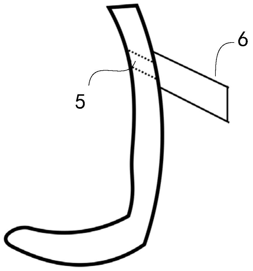 A 3D printed micro implant guide plate and its design method