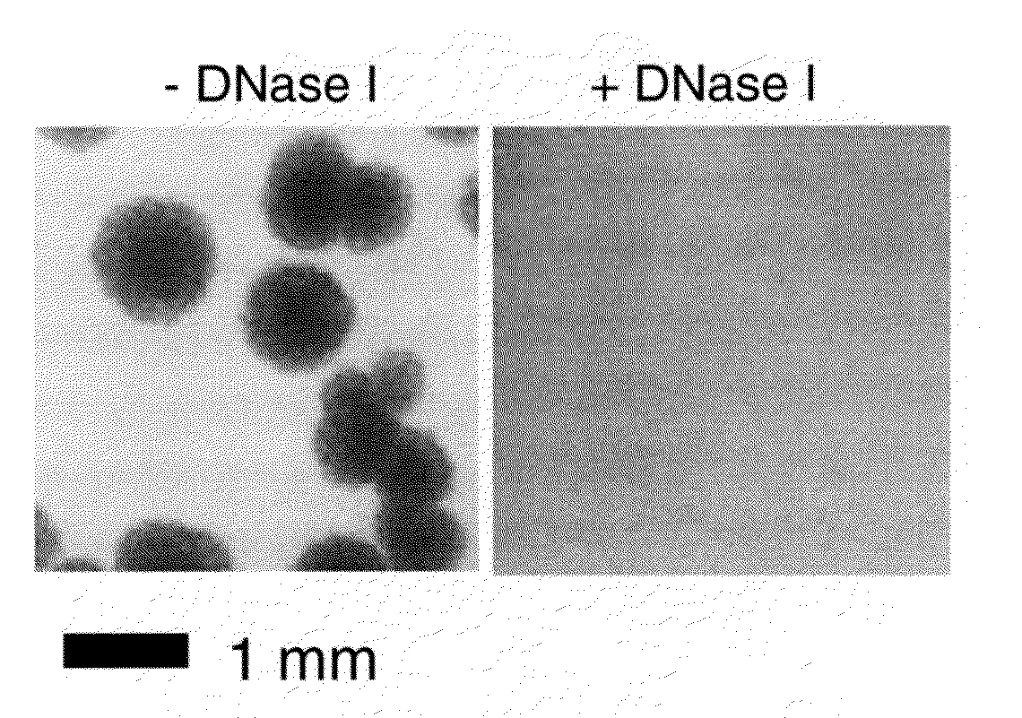 Compositions and methods for the treatment and prevention of infections caused by staphylococcus aureus bacteria