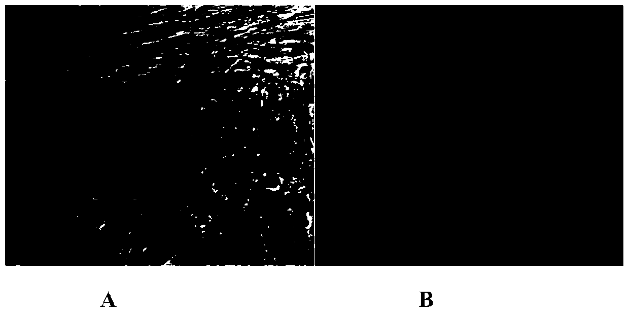 Mesenchymal stem cells with in vivo tracer and tumor treatment effects and preparation method thereof