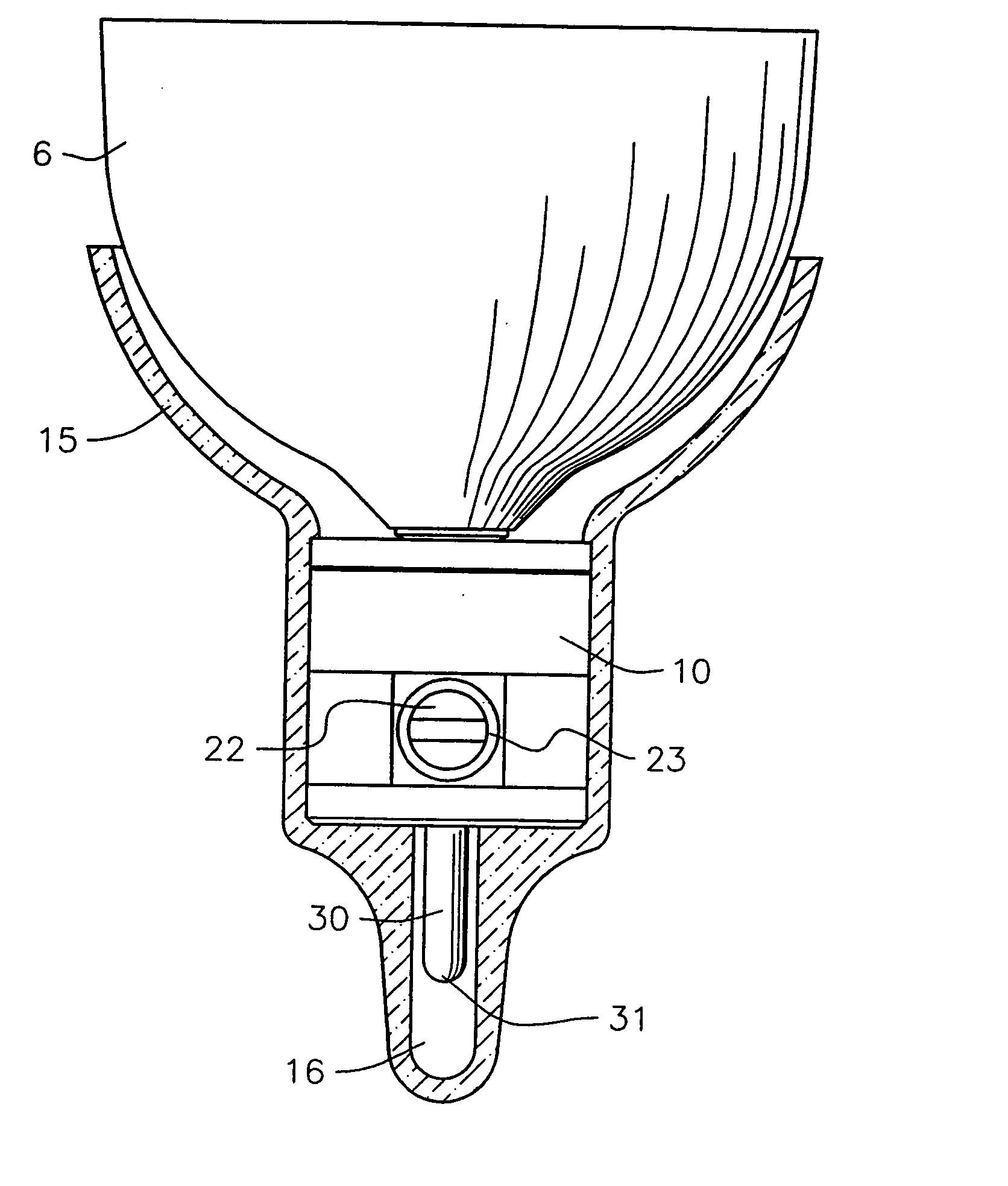 Prosthetic locking device