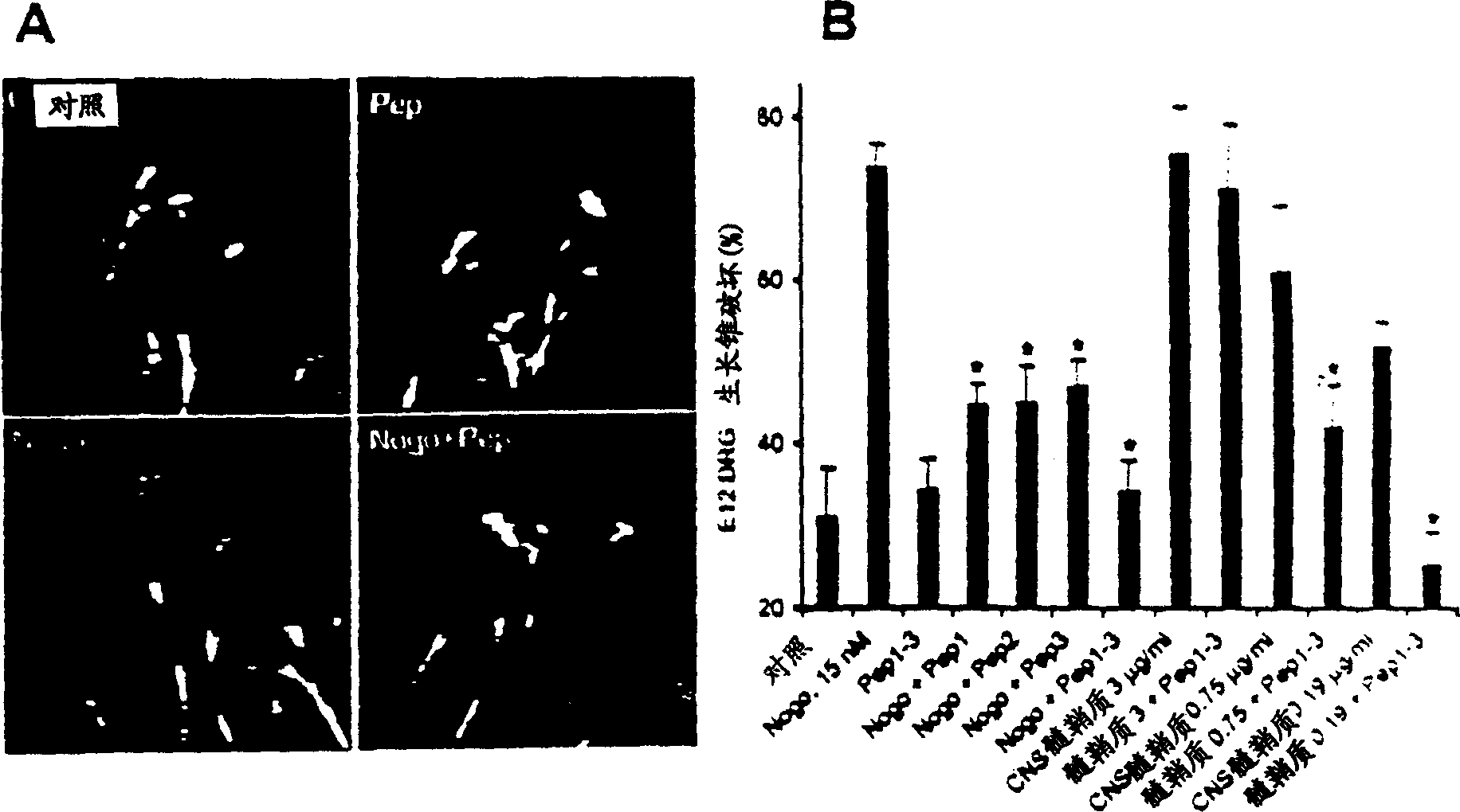 NOGO receptor-mediated blockade of axonal growth