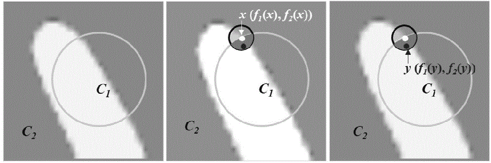 MR image segmentation and displacement field correction method based on geodesic models of local and global areas