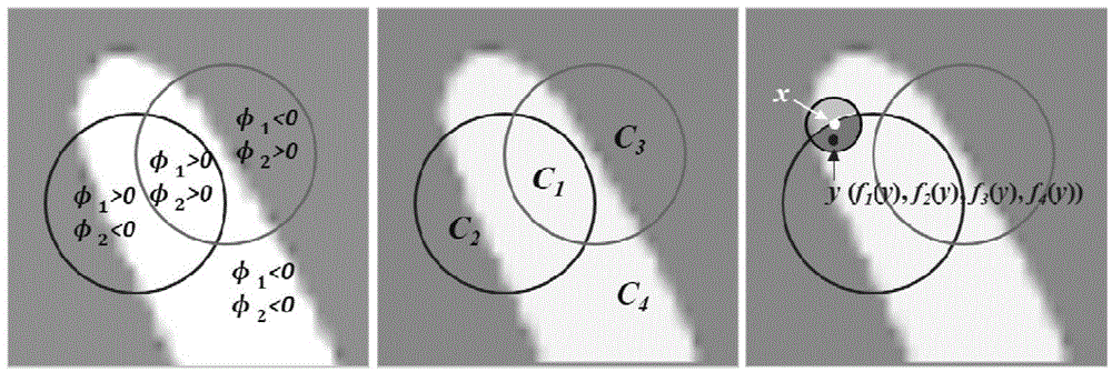 MR image segmentation and displacement field correction method based on geodesic models of local and global areas