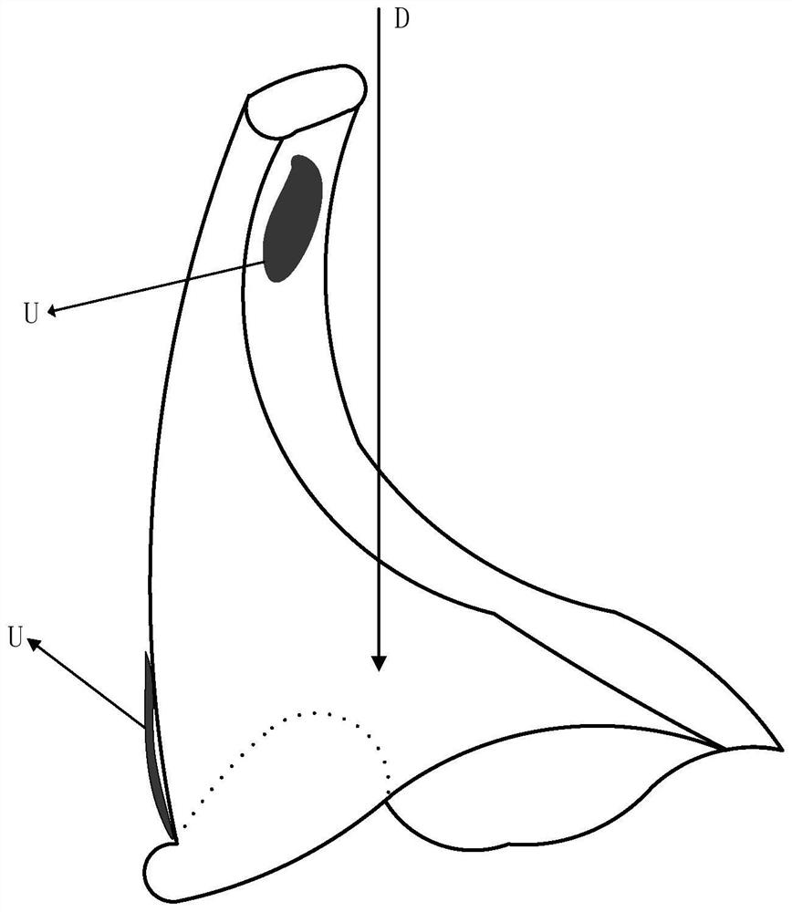 Novel computer-assisted removal method for dental crown preparation body undercut