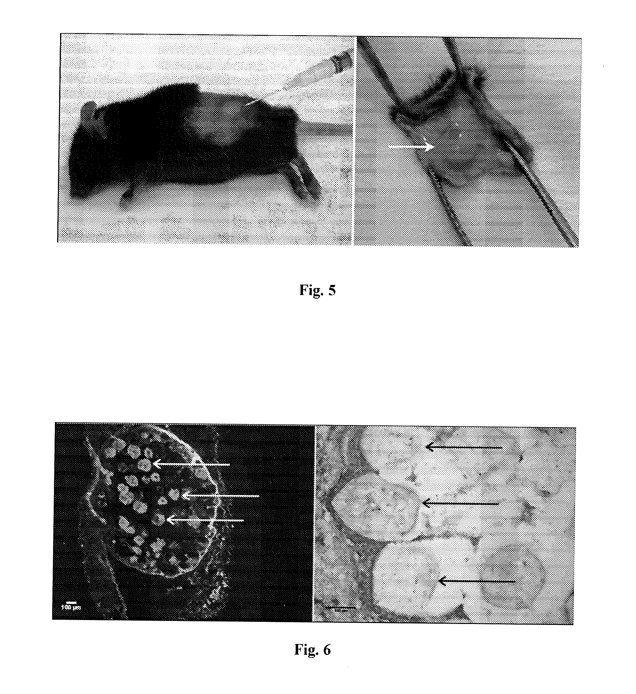 Crosslinked Polysaccharide Beads and Their Biomedical Uses