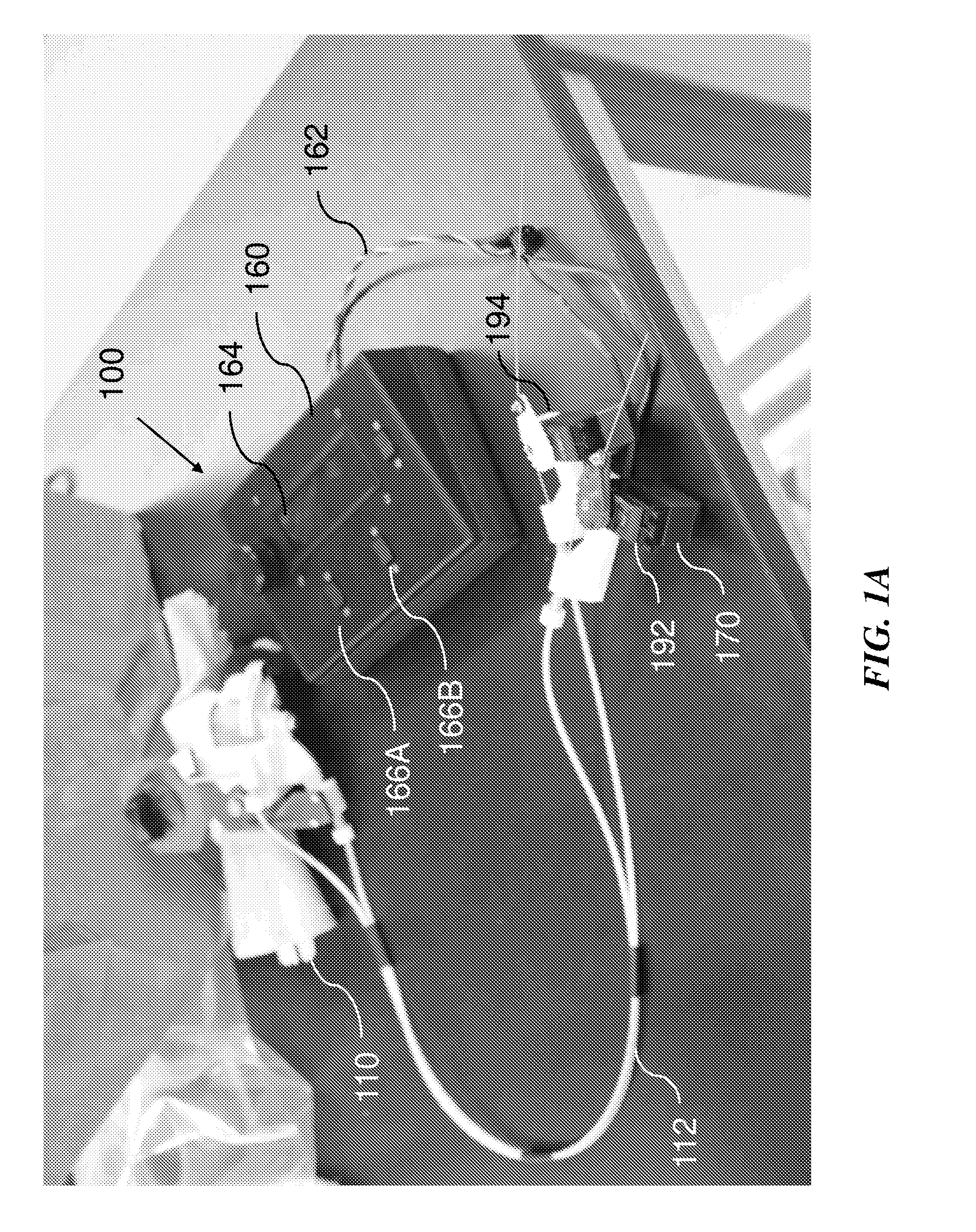 Isolated orthosis for thumb actuation