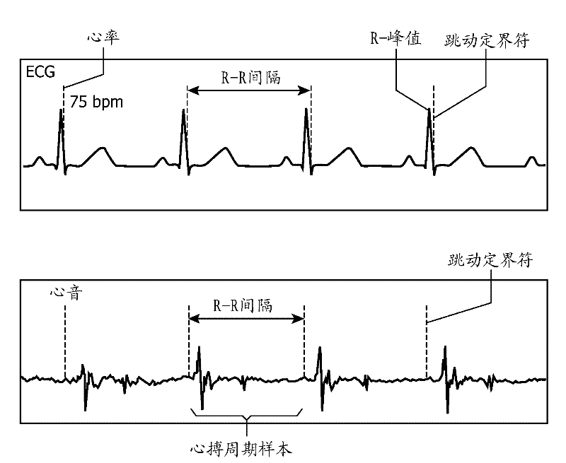 Method and system for processing heart sound signals