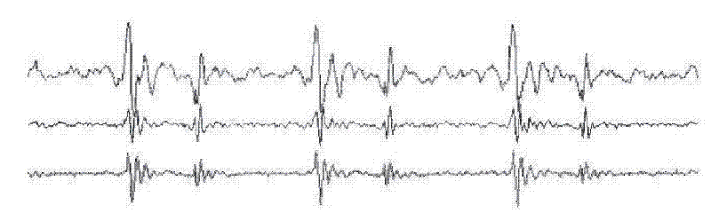 Method and system for processing heart sound signals