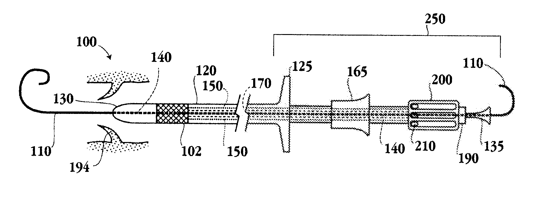 Methods for Delivery of a Sutureless Pulmonary or Mitral Valve