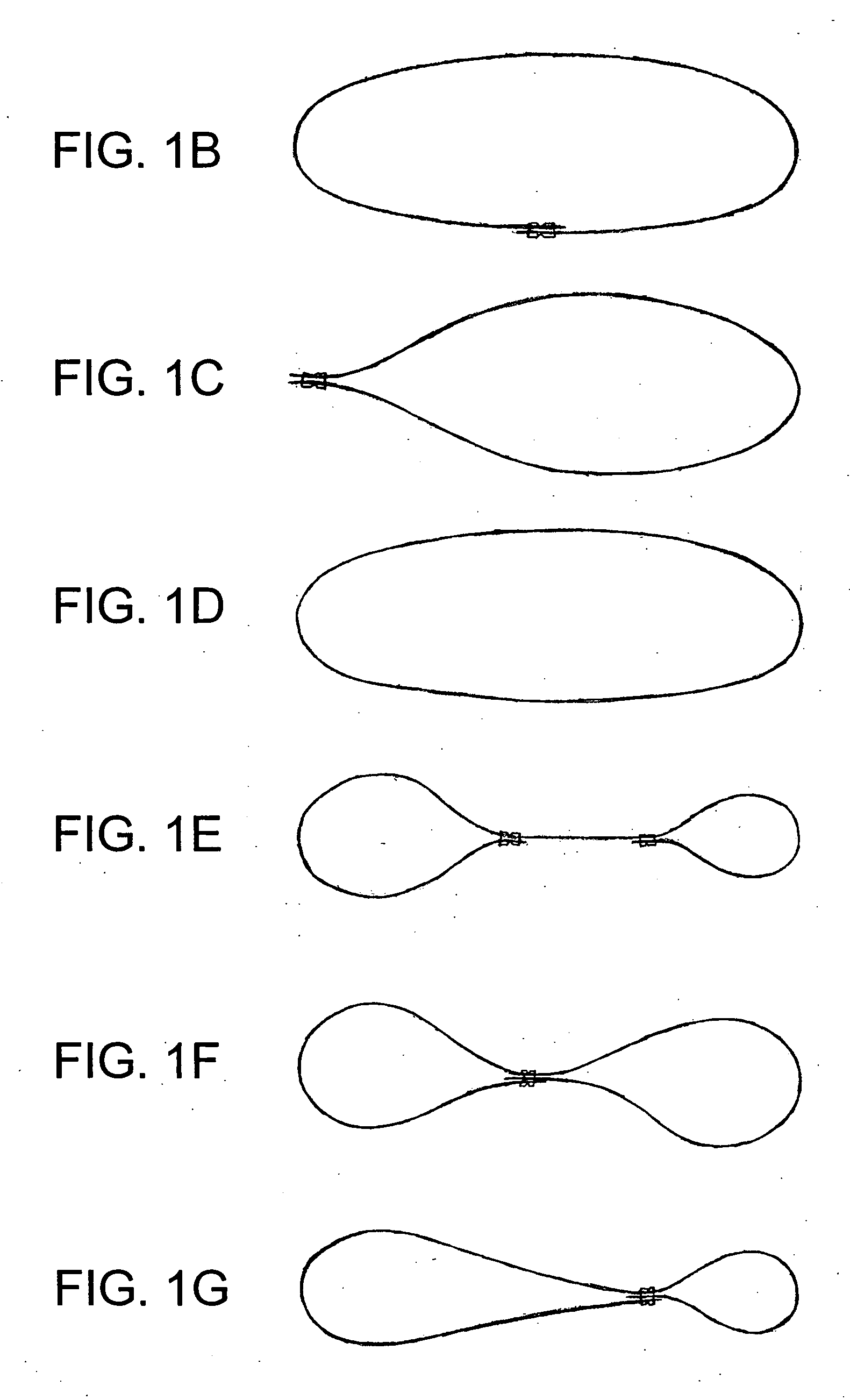 Ostomy tube device, ostomy placement kit and method for an ostomy tube placement