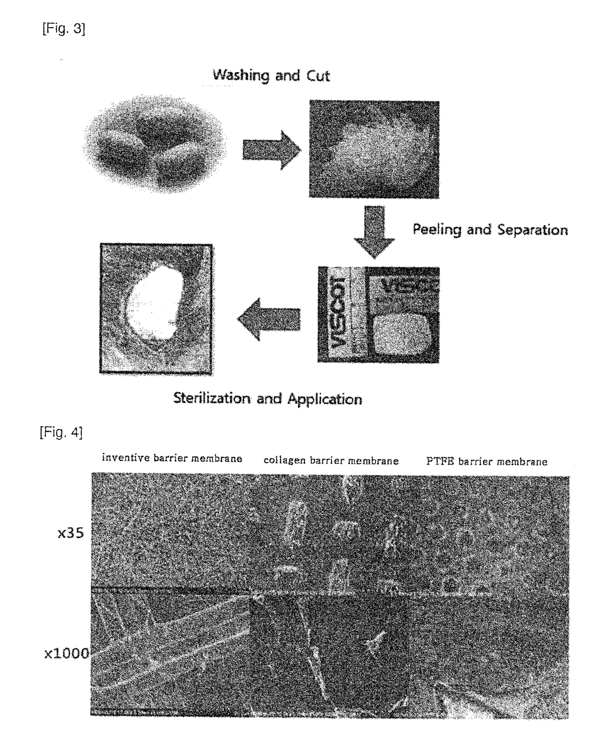 Dental barrier membrane using cocoon and method for manufacturing same