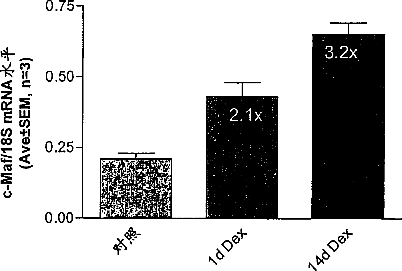 CDK2 antagonists as short form C-MAF transcription factor antagonists for treatment of glaucoma