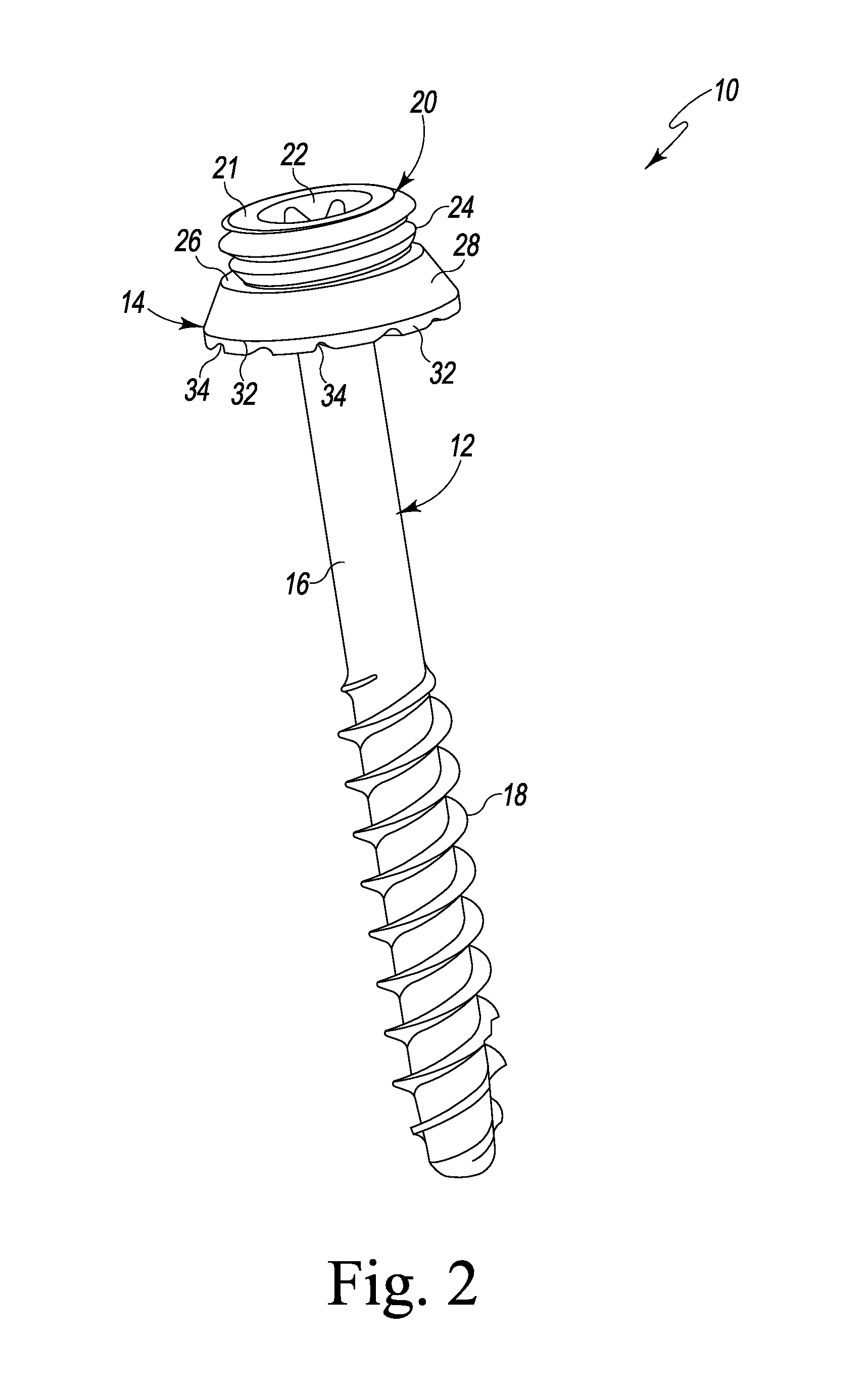 Spinal Facet Bone Screw System