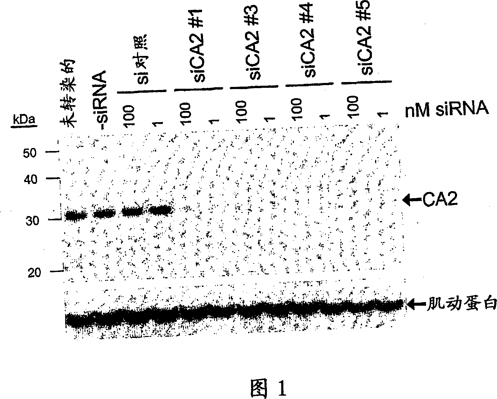 Rnai-mediated inhibition of ocular hypertension targets