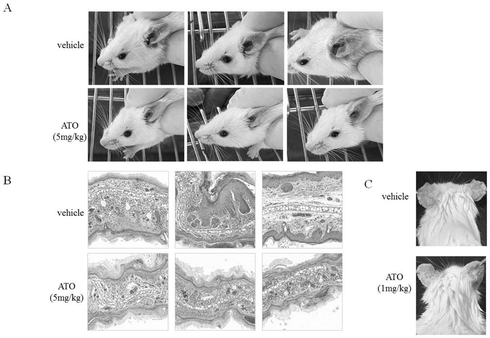 Application of arsenic trioxide and water-soluble substances thereof in preparation of medicine for treating atopic dermatitis