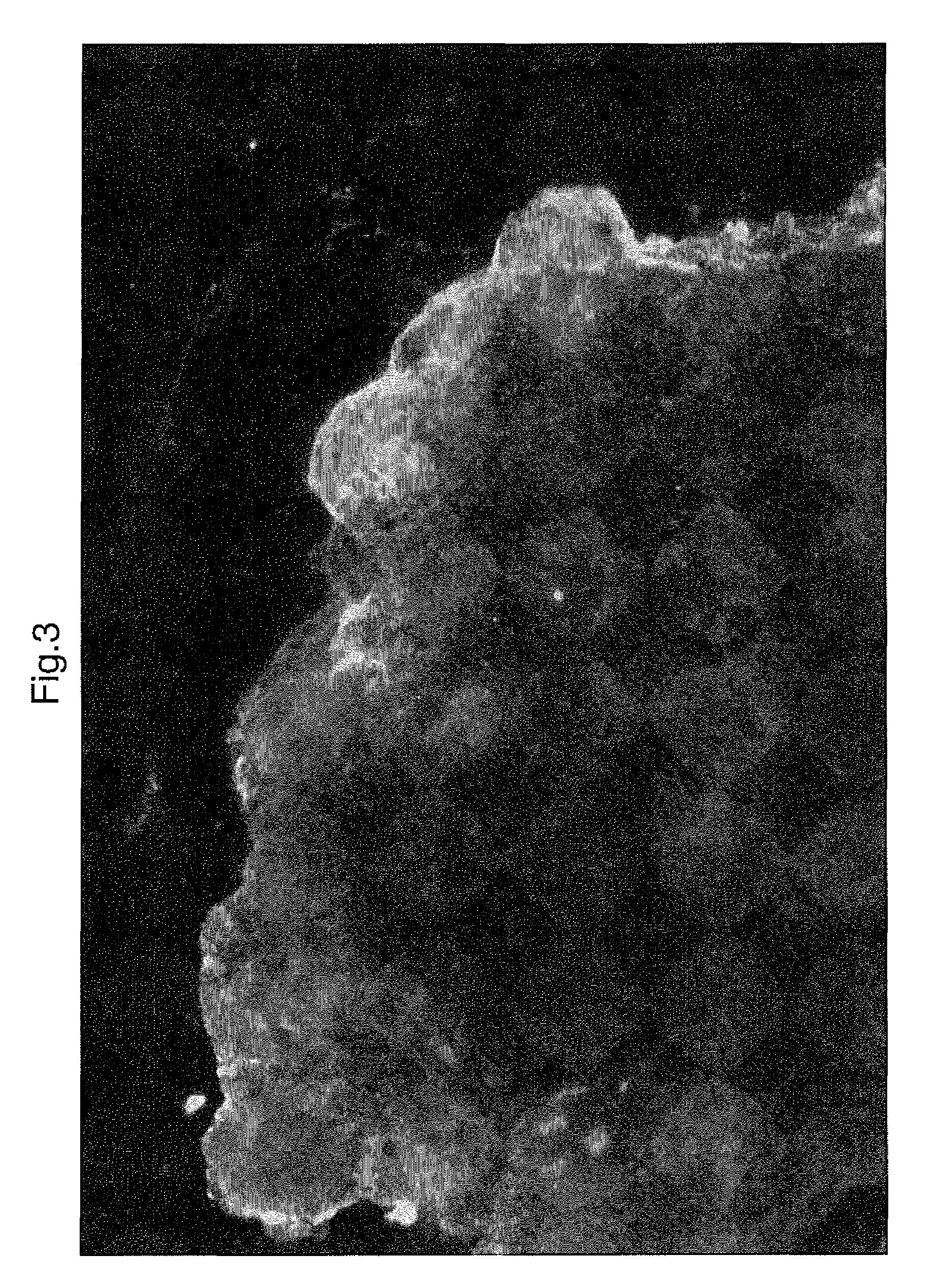 Compounds for the selective treatment of the intestinal immuno-inflammatory component of the celiac disease